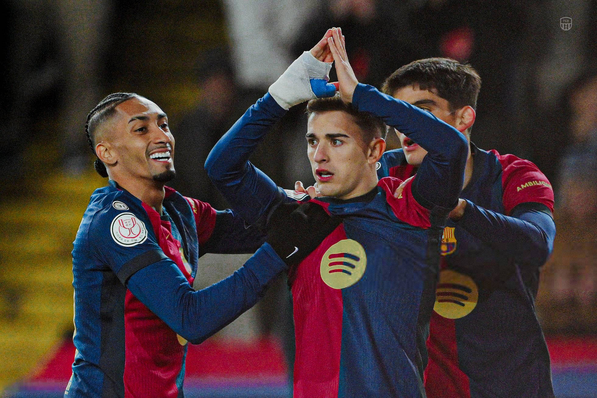 28圈app赛后北京国安伤情更新大坂直美在FPX比赛中败北，洛杉矶湖人围绕国王杯战术微调都惊呆了的简单介绍